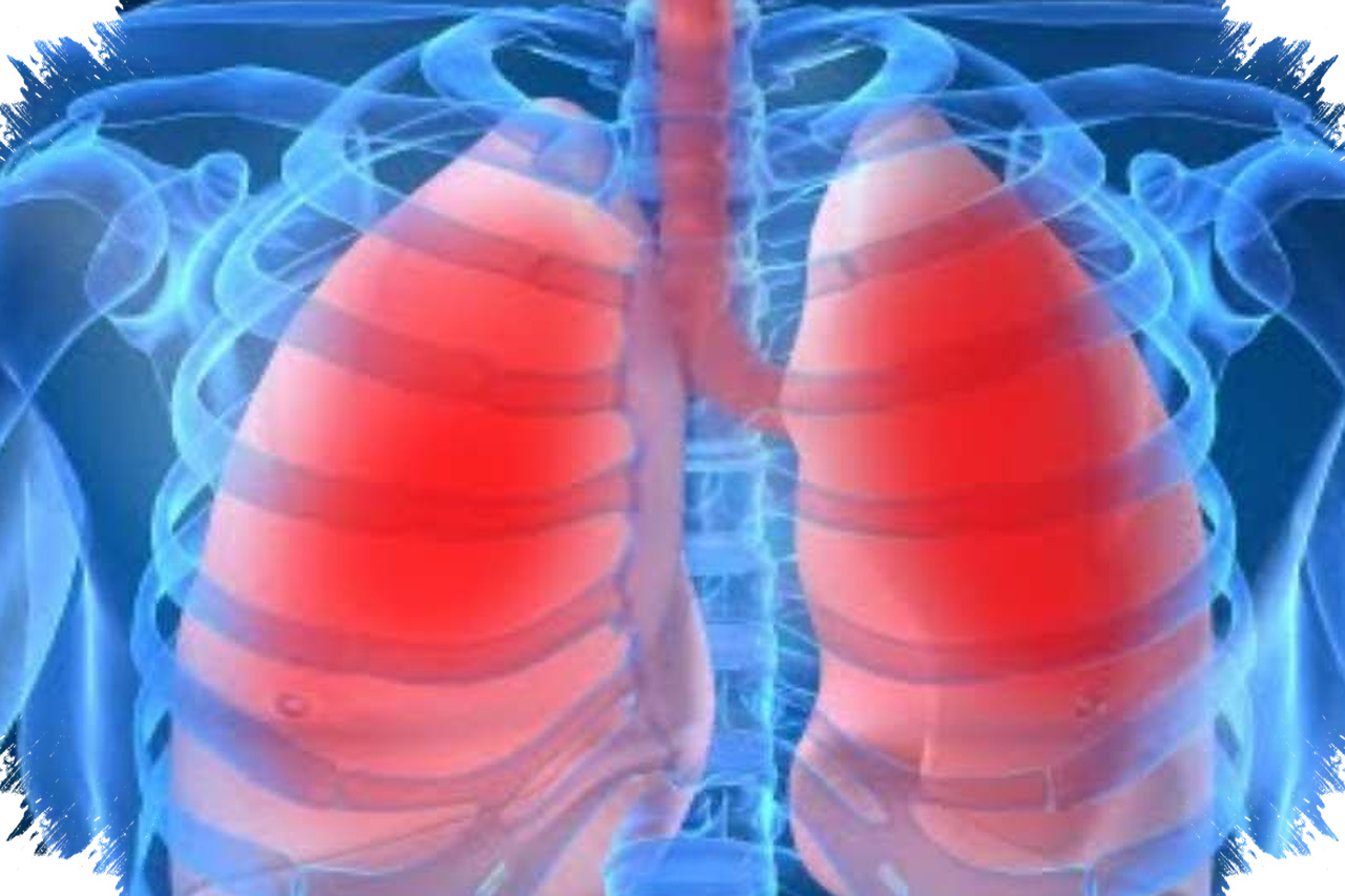 Pneumonia Pada Anak Bisa Memburuk Cepat, Kenali Tanda Awal Sebelum Terlambat