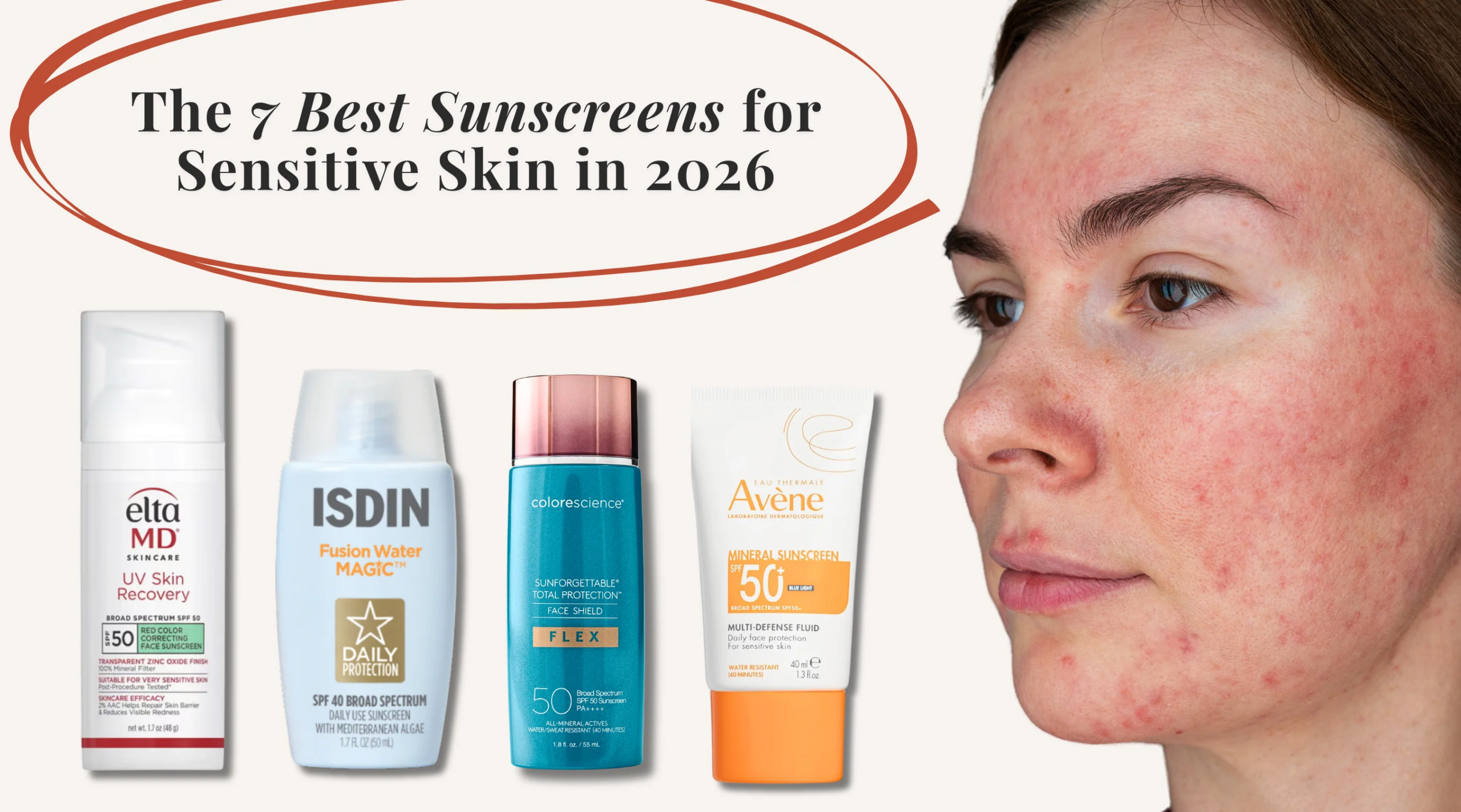 Saat Wajah Mudah Merah, 4 Physical Sunscreen Lokal Ber-Allantoin yang Paling Lembut di Kulit Sensitif