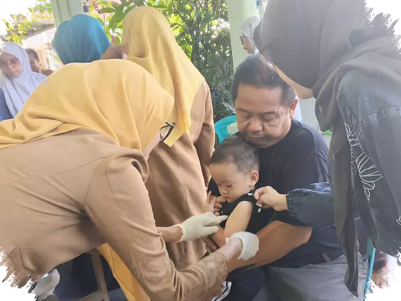 Serang Mendekati KLB, 500 Suspek Campak Mengintai Balita Di Banyak Kecamatan