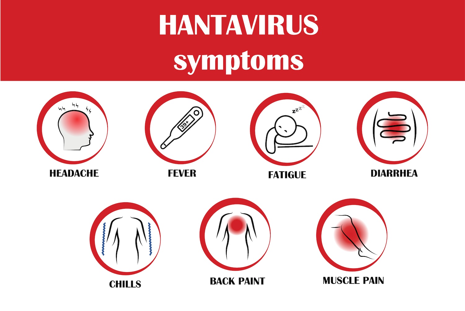 Hantavirus Bisa Menyamar Seperti Flu Biasa, Ini Penyebab Dan Gejala Awalnya