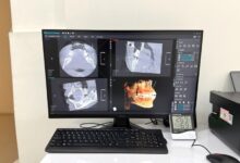 Rontgen Gigi 3D Baca Detail Rahang Dalam Hitungan Menit, Diagnosis Jadi Lebih Tepat