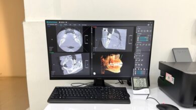 Rontgen Gigi 3D Baca Detail Rahang Dalam Hitungan Menit, Diagnosis Jadi Lebih Tepat