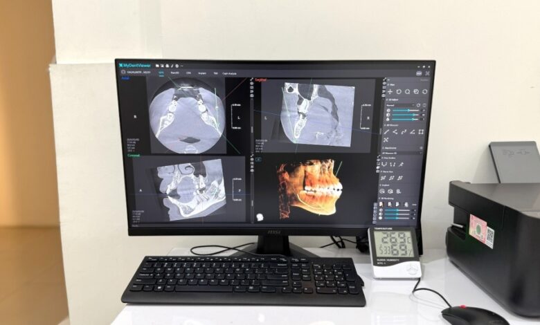 Rontgen Gigi 3D Baca Detail Rahang Dalam Hitungan Menit, Diagnosis Jadi Lebih Tepat