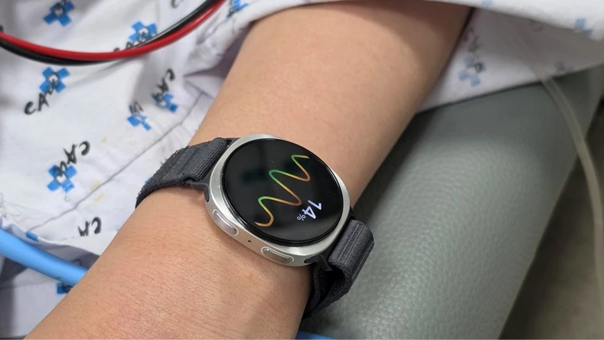 Galaxy Watch Tak Lagi Cuma Hitung Langkah, Samsung Ubahnya Jadi Pelatih Kesehatan AI