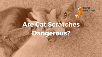 4 Risiko Zoonosis dari Kucing yang Sering Diremehkan, Cakaran hingga Rabies Mengintai