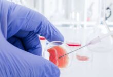Stem Cell Makin Luas Dipakai, Dari Awet Muda hingga Sendi yang Sulit Pulih