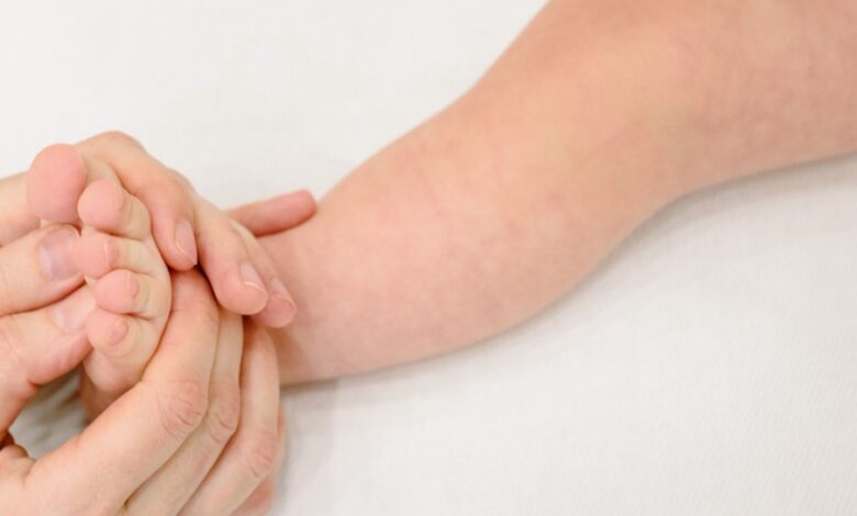 Skin Barrier Jadi Kunci, Cara Mencegah Eksim Bayi Kambuh di Tengah Kasus yang Meningkat
