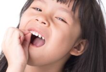 Perawatan Gigi Anak Tak Lagi Menegangkan, Klinik Ini Bikin Si Kecil Lebih Tenang