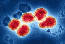523 Suspek Flu Singapura Tersebar di 16 Daerah Sumsel, Palembang Paling Tinggi