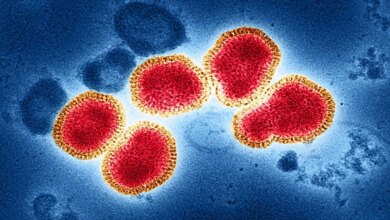 523 Suspek Flu Singapura Tersebar di 16 Daerah Sumsel, Palembang Paling Tinggi