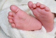 Gumoh Pada Bayi Tak Selalu Bahaya, Ini Tanda Saat Orang Tua Harus Waspada