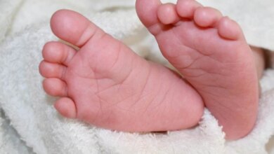 Gumoh Pada Bayi Tak Selalu Bahaya, Ini Tanda Saat Orang Tua Harus Waspada