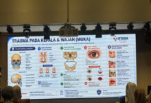 Trauma Kepala Hingga Perut Bisa Fatal, Ini Tanda Bahaya yang Tak Boleh Diabaikan