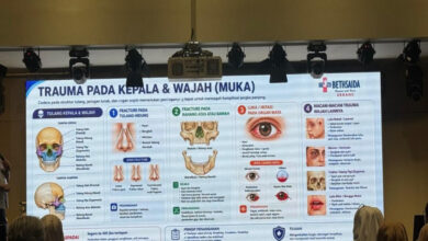 Trauma Kepala Hingga Perut Bisa Fatal, Ini Tanda Bahaya yang Tak Boleh Diabaikan